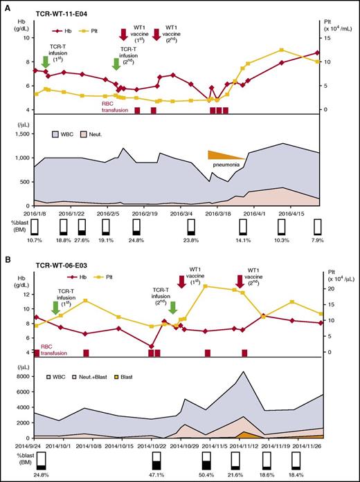 Figure 2. Clinical courses of TCR-WT-11-E04 and TCR-WT-06-E03 after the WT-specific TCR-T cell transfer. (A) The patient received 2 cycles of the TCR–T-cell therapy, and the second infusion was followed by 2 doses of WT1 peptide vaccination. One month after the second cycle, peripheral blood cell counts increased in association with a decrease in bone marrow blast counts. The patient did not require further red blood cell transfusion. (B) The patient received 2 cycles of the TCR-T cell therapy, and the second infusion was followed by 2 doses of WT1 peptide vaccination. After the second cycle, peripheral blood cell counts increased in association with decreased blast counts in bone marrow. Hb, hemoglobin; neut., neutrophil; Plt, platelet; RBC, red blood cell; WBC, white blood cell.
