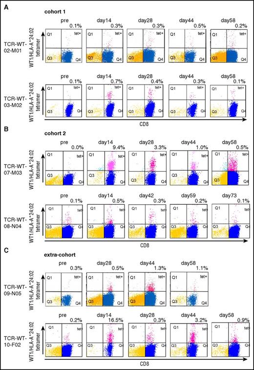 Figure 3. Tetramer analysis of the TCR-T cells at pre- and posttransfer times in peripheral blood. (A) PBMCs collected from 2 patients in cohort 1 (2 × 108 cells per infusion), before and after transfer of the TCR-T cells. CD8+ T cells were selected, stimulated in vitro with WT1 peptide, and assayed for tetramers of WT1 peptide/HLA-A*24:02. (B) PBMCs collected from 2 patients in cohort 2 (1 × 109 cells per infusion), before and after transfer of the TCR-T cells. (C) PBMCs collected from 2 patients who were allocated to cohort 2 (1 × 109 cells per infusion) and whose cells failed to proliferate to the target T-cell number, before and after transfer of the TCR-T cells.