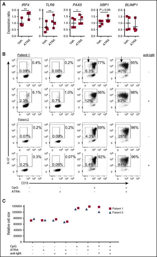 Figure 5. ATRA treatment of B cells from active cGVHD patients enhances genes involved in B-cell maturation. (A) B cells from active cGVHD patients (n = 4) were treated with ATRA (0.1 μM) or vehicle alone for 24 hours. The B cells were harvested, total RNA isolated, and real-time qPCR analysis performed to assess the expression levels of genes of interest. P values were determined using a paired Student t test (*P < .05; **P < .01). (B-C) Purified B cells from active cGVHD patients were plated in medium in the presence of ATRA (0.1 μM) or DMSO vehicle control. Following an initial culture period of 30 minutes, CpG (1 μg/mL) or anti-IgM Ab (0.625 μg/mL) were added alone or in combination. The cells were cultured for 72 hours, harvested, and flow cytometry analysis performed to assess Ki-67 and CD19 expression (B), as well as relative cell size by FSC (C). In panel B, the large gates with numbers outside indicate the frequency of Ki-67+ B cells, and the small gates (arrows) with numbers inside represent the frequency of proliferating, CD19low B cells.