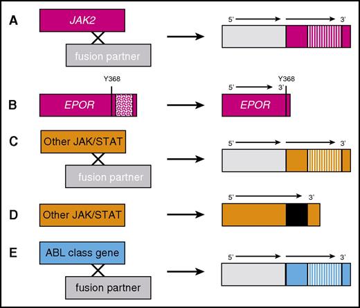 Figure 4. ABL-class kinase fusions and other JAK pathway alterations in Ph-like ALL. (A) JAK2 fusions are caused by translocations or interstitial deletions involving various 5′ fusion partners that lead to constitutive activation of the JAK2 3′ gene tyrosine kinase domain (striped bars). (B) Rearrangements of the EPOR gene with accompanying frameshift or stop codon mutations lead to overexpression of a truncated EPOR protein that lacks negative regulatory tyrosine (Y) residues (patterned box). Other JAK/STAT alterations (TYK2, IL7R, and TSLP) are caused by (C) translocations or (D) insertions, deletions, or missense mutations (black bar). (E) ABL-class (eg, ABL1, ABL2, CSF1R, and PDGFRB) kinase fusions occur via similar mechanisms as in panel A.