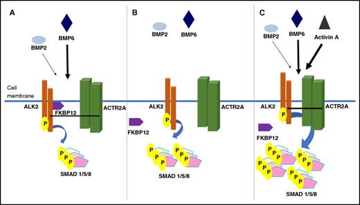 FKBP12 as a regulator of BMP/SMAD signaling. (A) When bound to ALK2, FKBP12 limits phosphorylation of SMAD 1/5/8 in response to canonical BMP signaling ligands. Upon release of FKBP12, which can occur either by mutation of ALK2 or by drug-mediated sequestration of FKBP12, ALK2 demonstrates enhanced signaling that is independent of ligand binding and phosphorylation by BMP type II receptors (B) and hyperresponsiveness to canonical BMP ligands and acquired responsiveness to the inflammatory ligand, activin A (C).