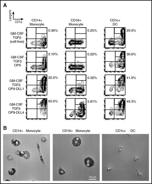 Figure 5. In vitro differentiation potential of monocytes and myeloid DCs. (A) Sorted CD14+ monocytes, CD16+ monocytes, and CD1c+ myeloid DCs from healthy controls cultured for 3 days in conditions as shown. LangerinhighCD1a+ gates depicted contain LCH-like cells with Birbeck granules. Notch ligands DLL1 And DLL4 were presented on transfected mouse OP9 cells. Representative data of 5 independent experiments. (B) Sorted CD14+ monocytes, CD16+ monocytes, and CD1c+ myeloid DCs from healthy controls cultured for 7 days with M-CSF and 5% human serum (HS) to reveal potential to differentiate into foamy macrophages. Representative phase contrast images of 5 independent experiments.