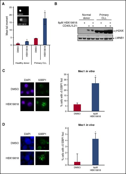 Figure 2. Inhibition of USP7 with HBX19818 induces accumulation of DNA damage. (A) DNA damage was significantly elevated both in primary CLL cells (n = 3) and healthy donor lymphocytes (n = 3) treated with 8-µM HBX19818 for 6 hours, as quantified from Comet assay–derived tail moments. HBX-induced DNA damage was increased 3.92-fold in CLL cells and 2.42-fold in healthy donor cells, relative to DMSO. Representative images of DMSO- and HBX19818-treated cells are depicted. (B) Levels of the DNA damage marker γH2AX increased after HBX19818 treatment of quiescent and proliferating primary CLL cells and proliferating healthy donor cells. Lamin B1 (LMNB1) was the loading control. Immunofluorescence labeling showed significant induction of 53BP1 foci, a DSB marker, in Mec1 cells after 6-hour treatment with HBX19818 in vitro (C) and in vivo (D) in the chemotherapy-resistant murine xenograft model. Representative images are shown (DAPI, blue; 53BP1, green) and the mean data from 3 independent experiments are presented. Original magnification ×60 (A,C-D). Data were compared using a 2-tailed Student t test, and statistical significance denoted by: *P ≤ .05.