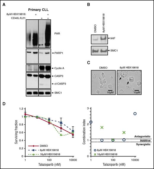 Figure 4. USP7 inhibitor HBX19818 increased PARP1, protein PARylation, and nuclear apoptosis-inducing factor. (A) HBX19818 treatment (6 hours) elevates PARP1 and PARylated protein levels in the absence of caspase-3 cleavage (cl-CASP3) in both quiescent (without CD40L/IL-21) and proliferating (with CD40L/IL-21) primary CLL cells. CD40L/IL-21–stimulated proliferation was confirmed by the presence of cyclin A expression. SMC1 was the loading control. (B) Analysis of nuclear extracts from proliferating primary CLL cells demonstrated that HBX19818-induced translocation of apoptosis-inducing factor (tAIF) accumulation in the nucleus. (C) HBX19818 treatment for 72 hours induced CLL cells to swell and disperse their contents (arrows), morphological changes that are consistent with necrotic cell death. (D) In ATM/p53-defective primary CLL induced to proliferate (n = 6) the PARP inhibitor talazoparib did not potentiate the cytotoxic activity (left) of HBX19818 and acted in an antagonistic manner, as indicated by combination indices (right).