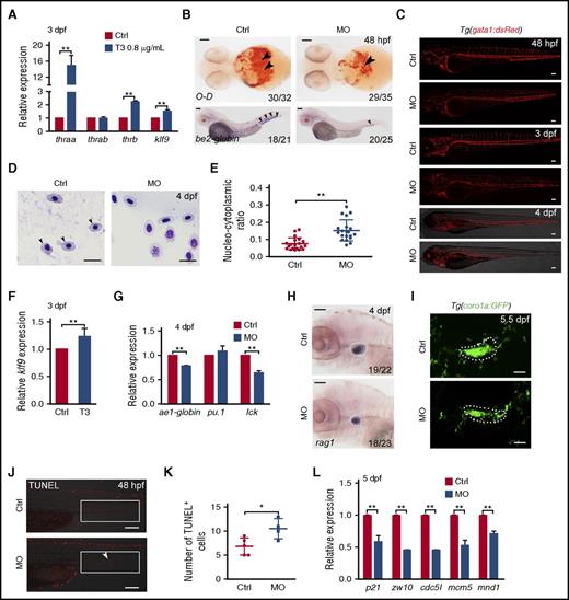 Figure 5. klf9 mediates the TH/TR axis to regulate hematopoiesis. (A) The qRT-PCR results showed that the expression levels of klf9, thraa, and thrb were significantly upregulated in the T3-treated zebrafish embryos compared with the controls at 3 dpf (means ± SD; **P < .01; n = 3). (B) O-dianisidine (O-D) staining of hemoglobin and be2-globin expression by WISH revealed that mature erythrocytes were decreased in klf9 morphants compared with control embryos at 48 dpf. RBCs are indicated by arrowheads. Scale bar, 100 μm. (C) Confocal imaging of Tg(gata1:dsRed) showing fewer gata1:dsRed cells in klf9 morphants at 48 hpf, 3 dpf, and 4 dpf. Scale bar, 100 μm. (D) Blood smear and Giemsa staining. At 4 dpf, the size and nucleocytoplasmic ratio of RBCs from klf9 morphants were increased compared with those from controls. The arrowhead marks the mature RBCs. Scale bar, 10 μm. (E) Scatter plots of the nucleocytoplasmic ratio in control and klf9 morphants (means ± SD; **P < .01; n = 20). (F) The qRT-PCR result displayed that klf9 expression was increased in gata1+ cells after T3 treatment from 10 hpf to 3 dpf (means ± SD; **P < .01; n = 5). (G) The qRT-PCR results showed that ae1-globin and lck expression levels were significantly decreased in klf9 morphants compared with controls at 4 dpf (means ± SD; **P < .01; n = 3). (H) WISH result showed that the expression of T-cell marker rag1 was decreased in klf9 morphants at 4 dpf. The white dashed lines indicate the thymus region. Scale bars, 100 μm. (I) Confocal imaging of Tg(coro1a:GFP) showed that T cells in the thymus (dashed line) were decreased in klf9 morphants compared with controls at 5.5 dpf. Scale bars, 40 μm. (J-K) The quantification of apoptotic cells in the caudal hematopoietic tissue (white boxes) showed that the number of TUNEL+ cells (arrowhead) was 1.5-fold higher in morphants than that in controls at 2 dpf (means ± SD; *P < .05; Ctrl, n = 5; MO, n = 4). Scale bars, 100 μm. (L) The qRT-PCR results showed that the expression levels of cell division–associated genes were downregulated in klf9 morphants at 5 dpf (means ± SD; **P < .01; n = 3). Ctrl, control; MO, klf9 MO.