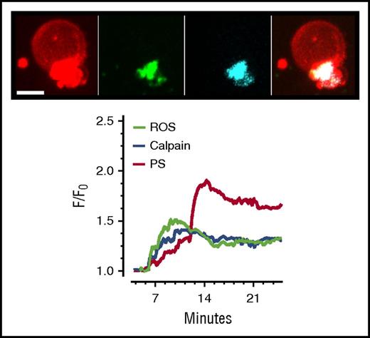 Figure 2. Spatiotemporal pattern of calpain activation, PS exposure, and reactive oxygen species generation in the ballooning platelet. Extended focus images obtained at 20 minutes after platelet adherence to fibrillar collagen show the spatial location of exposed PS indicated in red (as monitored by membrane annexin-V accumulation), calpain indicated in cyan, and reactive oxygen species (ROS) indicated in green. Calpain activity was monitored by the 7-amino-4-chloromethylcoumarin (CMAC)-based substrate, fluorogenic t-BOC-Leu-Met-CMAC substrate, which yields fluorescent peptidase products with improved retention in live platelets. The generation of ROS during membrane ballooning was followed in real time by means of MitoSox (ThermoFisher Scientific), which is rapidly oxidized by superoxide to produce highly fluorescent products. The chart shows the temporal profile of calpain activation, PS exposure, and ROS generation in a ballooning human platelet. Written informed consent was obtained in accordance with the Declaration of Helsinki. Human blood was obtained from healthy, drug-free volunteers under the University of Bristol, United Kingdom, Research Ethics approval (E5736). Live cell imaging was performed at 25°C using a spinning-disk confocal system as previously described.8,18 Scale bar represents 3 µm. Data are representative of 4 independent experiments. F/F0, relative fluorescence intensity over time, where F0 is the background-subtracted fluorescence intensity before platelet activation.
