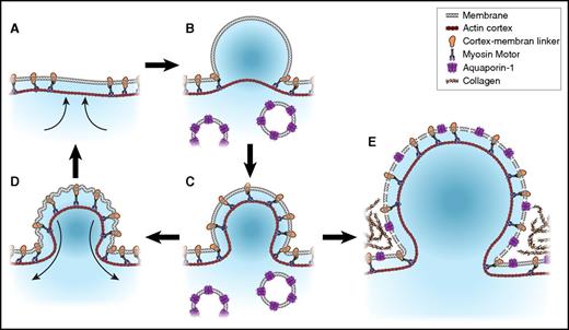 Figure 3. Membrane blebbing and ballooning in human platelets. Membrane blebbing is initiated by localized cortical actin contraction (A),65 which weakens the membrane-cytoskeleton interaction and allows internal hydrostatic pressure to drive membrane protrusions (<1 µm diameter). This may be accompanied by a further detachment of the membrane from the cortex and a total volume change of <10% (B). The recruitment of myosin to the expanded cortex enables bleb retraction (C-D).65,66 Blebs were shown to form at 1 or more sites on platelet membranes upon contact with collagen and are retractable and may be re-formed.8 At some point, usually a single bleb would undergo a rapid increase in volume, resulting in a characteristic platelet balloon (E).8