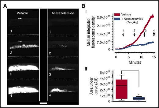 Figure 4. Acetazolamide suppresses thrombus formation in vivo. Mice were administered acetazolamide (7 mg/kg) or vehicle by single bolus intravenous injection, followed immediately by DyLight 488–conjugated anti-GPIbβ antibody to label platelets. Carotid artery damage was achieved by treatment with FeCl3 as previously described.8 Fluorescently labeled platelets adhering at the site of injury could then be imaged continuously by intravital fluorescence microscopy. Images at frames indicated in panel A correspond to time points indicated in panel Bi, which shows median fluorescence intensity, quantified by using ImageJ. Analysis of the area under the curve for media fluorescence is shown in panel Bii as interleaved box plots with whiskers showing minimum to maximum values, median, and interquartile range. Data analysis was by Wilcoxon signed rank test, P < .05. *Considered significant. Scale bar, 500 µm. Data are from 8 pairs of mice. Reproduced with permission from Agbani et al.8