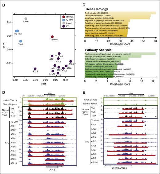 Figure 1. Super-enhancer profiling in ATL samples. (A) Enhancers were ranked by increasing H3K27Ac signal in 10 primary ATL cases and 1 ATL cell line (TL-Om1). The number of super-enhancers (SEs) is shown for each sample. Examples of genes that were commonly associated with super-enhancers in ≥5 primary ATL cases are shown. (B) PCA was performed for 1 T-ALL cell line (Jurkat), 1 normal thymus sample, 3 normal CD4+ T-cell populations (Th1, Th2, and Th17), 1 ATL cell line (TL-Om1), and 10 primary ATL cases (ATL1-10) based on the super-enhancers identified in each sample. Each circle represents a sample, and each color represents the type of sample. (C) Genes commonly associated with super-enhancers in primary ATL cases were subjected to gene ontology analysis (biological process) and KEGG pathway analysis. The top 10 categories are shown with combined scores. (D-E) The ChIP-seq gene tracks represent the H3K27Ac signal in immature T cells (Jurkat and normal thymus), normal CD4+ T-cells (Th1, Th2, and Th17), and ATL cells (TL-Om1 and 10 primary ATL samples) at the CD2 (D) and IL2RA/CD25 (E) gene loci. The x-axis indicates the linear sequence of genomic DNA, and the y-axis indicates the total number of mapped reads per million. The black boxes in the gene map represent exons, and the arrows indicate the location and direction of the TSS. The super-enhancers are shown as red lines.
