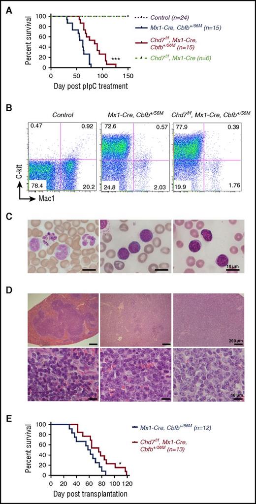 Figure 1. Chd7 deficiency delays Cbfb-MYH11–induced leukemia. (A-D) Mice were treated with ENU to induce mutations and then with poly(I:C) to induce the expression of Cbfb-MYH11 and/or Chd7 deficiency, and leukemia development in these mice was monitored. (A) Kaplan-Meier survival curves of mice with indicated genotypes during a 5-month observation of leukemia development. (B) Representative FACS plots of peripheral blood cells stained with c-Kit and Mac1. (C) Representative Wright-Giemsa–stained peripheral blood smears. (D) Representative hematoxylin and eosin–stained spleen sections (upper panel, ×50; bottom panel, ×400) from control, end-stage Mx1-CreCbfb+/56M, and Chd7f/fMx1-CreCbfb+/56M mice. (E) Kaplan-Meier survival curves of mice transplanted with 1 million spleen cells from end-stage Mx1-CreCbfb+/56M and Chd7f/fMx1-CreCbfb+/56M mice. *P < .05; ***P < .001, each comparing the Chd7f/fMx1-CreCbfb+/56M group with the Mx1-CreCbfb+/56M group.