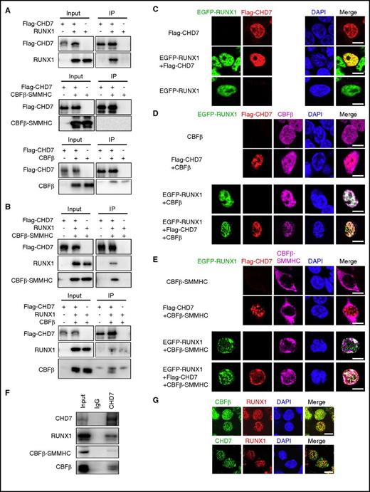 Figure 4. CHD7 interacts with RUNX1, RUNX1/CBFβ, and RUNX1/CBFβ-SMMHC complex. (A-B) 293T cells were transfected with indicated plasmids, and co-immunoprecipitation assays were performed to detect the interaction among these proteins. Flag-tagged CHD7 was immunoprecipitated with anti-Flag M2 beads, and western blot was performed with the indicated antibodies. (A) CHD7 pulls down RUNX1 but not CBFβ or CBFβ-SMMHC. (B) CHD7 pulls down CBFβ and CBFβ-SMMHC in the presence of RUNX1. (C-E) 293T cells were transfected with the indicated plasmids, and immunofluorescence assay was performed to detect the interaction between the indicated proteins. The labels on the left of the photomicrographs indicate the transfected plasmids; labels on the top indicate the observed proteins at the appropriate microscope filter settings. (F) Co-immunoprecipitation assay was performed in ME-1 cells with anti-CHD7 antibody, and western blot was performed with the indicated antibodies. (G) Immunofluorescent staining of leukemic cells from the spleen of an end-stage Mx1-CreCbfb+/56M mouse to detect the co-localization between RUNX1 and CHD7 (top panel) and between RUNX1 and CBFβ/CBFβ-SMMHC (bottom panel). Scale bars, 10 μm. DAPI, 4′,6-diamidino-2-phenylindole; IgG, immunoglobulin G; IP, immunoprecipitate.