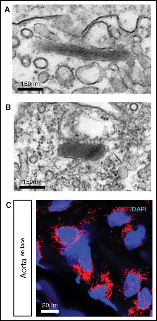 Figure 4. Punctate Vwf staining and presence of WPBs in hagfish endothelial cells. Representative electron microscopy image of hagfish endothelium from aorta (A) and skeletal muscle arteriole (B) showing the presence of cigar-shaped organelles containing electron-dense tubules, consistent with WPBs. (C) Confocal laser scanning microscopy image of en face hagfish aorta processed for immunofluorescence staining of Vwf using polyclonal anti-human VWF antibody (see supplemental Figure 3 for images using hagfish monoclonal Vwf antibody). Nuclei are stained with DAPI. Note the presence of punctate staining in the endothelial cells. All stain and magnification information for photomicrographs is provided in the supplemental Material.