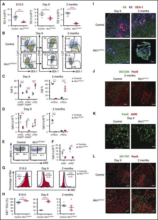 Figure 4. Progressive loss of TECs in Mcl1ΔFoxn1 mice. (A) TEC (CD45−MHC II+EpCAM+) numbers from control and Mcl1ΔFoxn1 mice at different time points. Representative flow cytometry plots (B) and graphs showing proportions (C) and absolute numbers (D) of cTECs (Ly51+UEA-1−) and CD80+ and CD80− mTECs or total mTECs (Ly51−UEA-1+). Representative flow cytometry plots (E) and graphs showing absolute numbers (F) of CD80+ mTECs expressing AIRE in day 9 Mcl1ΔFoxn1 mice. Representative histograms (blue and red histograms show controls and Mcl1ΔFoxn1 mice, respectively) (G) and graphs showing proportions of proliferating Ki67+ TECs (H). Data are representative of at least 2 independent experiments (n ≥ 3/group) (except TEC subset data for day 9). Graph bars indicate mean ± SEM and groups were compared with a Student t test (2 sided, unpaired). *P < .05; **P < .01; ***P < .001; ****P < .0001. The control group combines various combinations of genotypes (Foxn1Cre/+Mcl1+/+, Foxn1+/+Mcl1lox/+, Foxn1+/+Mcl1lox/lox, Foxn1Cre/+Mcl1lox/+) that showed no differences from each other in separate experiments. Immunofluorescence images of thymic sections from day 9 and 2-month-old control and Mcl1ΔFoxn1 mice stained with anti-K8, anti-K5, and UEA-1 (I); anti-DEC205 and anti-PanK (J); anti-PanK and AIRE (K); and ER-TR7 and anti-PanK (L). Scale bars represent 100 µm (I, J, L) and 50 µm (K). PanK, pan-keratin.