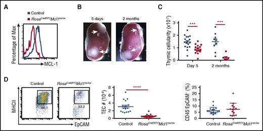 Figure 6. An ongoing requirement for MCL-1 in TEC survival. (A) Representative flow cytometry plots of MCL-1 expression in CD45−EpCAM+MHC II+ TECs isolated from grafts 5 days after the third dose of tamoxifen treatment. (B) Photos of experimental (denoted as “E” for RosaCreERT2 Mcl1lox/lox) and control (“C”) thymic lobes grafted under the renal capsule of C57BL/6-Ly5.1 males analyzed at indicated time points after 3 doses of tamoxifen treatment. (C) Total cell numbers recovered from grafts at the indicated time points after third dose of tamoxifen treatment. (D) Flow cytometry plots of MHC II and EpCAM gated on CD45−EpCAM+ TECs (representative of 3 experiments performed on 14-17 mice) and graphs of the number of CD45−EpCAM+MHC II+ TECs (middle) and proportion of CD45−EpCAM− recovered from grafts 5 days after the third dose of tamoxifen treatment. Bars indicate mean ± SEM and groups were compared with a Student t test (2 sided, unpaired). ***P < .001; ****P < .0001. Controls include various combinations of genotypes (RosaCre/CreMcl1lox/+, Rosa+/+Mcl1lox/+, Rosa+/+Mcl1lox/lox).