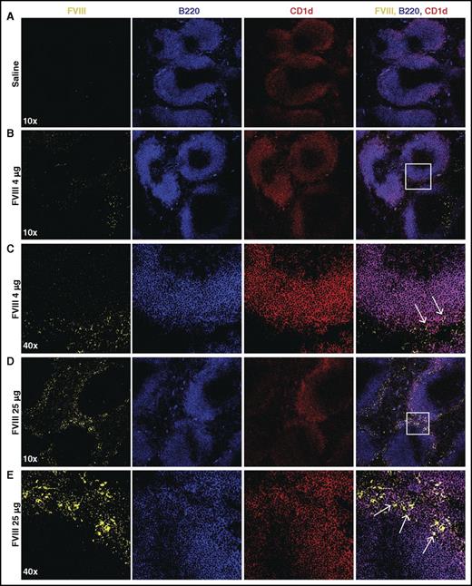 Figure 1. FVIII localizes in the marginal sinus of the spleen with MZ B cells. FVIII-deficient mice were injected with saline (A), 4 μg of FVIII (B-C), or 25 μg of FVIII (D-E), followed by splenic harvest 15 minutes post injection. Frozen spleen sections were stained with polyclonal sheep anti-FVIII-FITC (yellow), B220-PE-CF594 (blue), and CD1d-PE (red). Images were obtained using the Leica SP8 multiphoton confocal microscope and are shown at 10× and 40× magnification. White box indicates area magnified at 40×. Arrows indicate colocalization of FVIII and CD1d (MZ B cells).