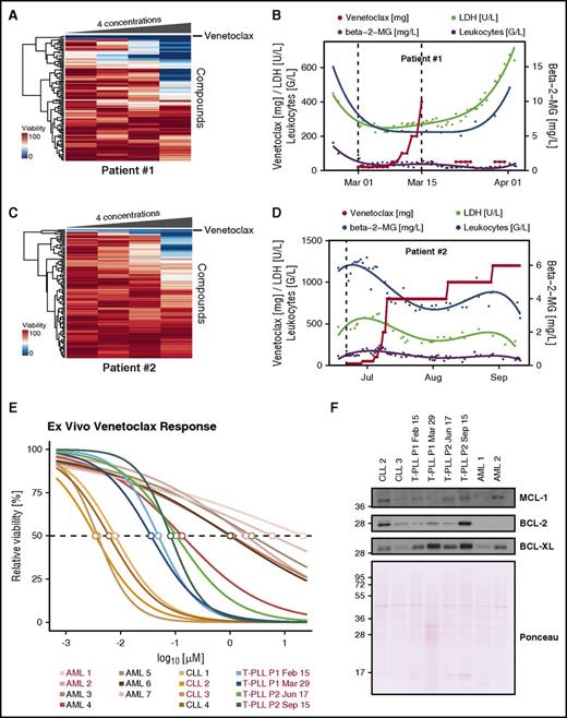 Figure 2. Venetoclax ex vivo response matches clinical response in 2 T-PLL patients. (A) Heatmap of viability measurements for 106 compounds in 4 concentrations in patient 1. The 4 concentrations used for each compound are depicted in supplemental Table 1. Venetoclax clusters on top. (B) Clinical response of T-PLL patient 1. (C) Heatmap of viability measurements for 106 compounds in 4 concentrations in patient 2. Venetoclax clusters on top. (D) Clinical response of T-PLL patient 2. (E) Dose-response curve of venetoclax of patients 1 and 2 before and after venetoclax treatment as well as CLL and AML samples. Concentrations ranging from 0.7 nM to 13 µM in threefold dilutions at 10 concentration points with 8 replicates each. Samples used for western blot in panel F are marked in red. (F) Western blot for BCL-2, BCL-XL, and MCL-1 of samples used in panel E. Total protein stain was performed with Ponceau S. Antibodies used were: BCL-2 (BD Biosciences), MCL-1 (Cell Signaling Technology), BCL-XL (Cell Signaling Technology), horseradish peroxidase (HRP)-conjugated donkey anti-mouse, and HRP-conjugated donkey anti-rabbit (Jackson ImmunoResearch).