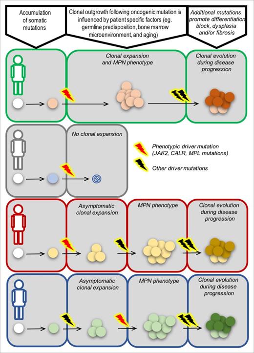 Figure 3. From origins to outcomes. Different evolutionary paths to MPN and disease progression in 4 patients, each with a unique genetic background (green, gray, red, blue). In the first patient (green), a phenotypic driver mutation acquired in an HSC results in clonal expansion and the emergence of an MPN phenotype as a consequence of favorable cell-intrinsic and/or environmental factors. The MPN in this context has no additional oncogenic driver mutations, as is common for patients in chronic phase. Additional driver mutations, such as those that perturb polycomb repressor 2 function (EZH2, ASXL1 mutations), spliceosome components (SRSF2, SF3B1, U2AF1), or DNA damage repair (TP53), can lead to cells gaining a further clonal advantage and disease progression. In the second patient (gray), the cell-intrinsic and/or environmental context is not favorable, and a cell acquiring a phenotypic driver mutation does not have a clonal advantage relative to competing normal cells. In some circumstances, a phenotypic driver mutation may be insufficient to result in abnormal blood counts and an overt MPN but can instead result in a clonal expansion. Additional mutations or cell-extrinsic changes may be required to result in emergence of disease (patient in red). Finally, in some patients, phenotypic driver mutations may not be the first event. Clonal hematopoiesis as a result of mutations in, for example, TET2, DNMT3A, ASXL1 may be the required backdrop for a phenotypic driver mutation to result in an overt MPN (patient in blue).