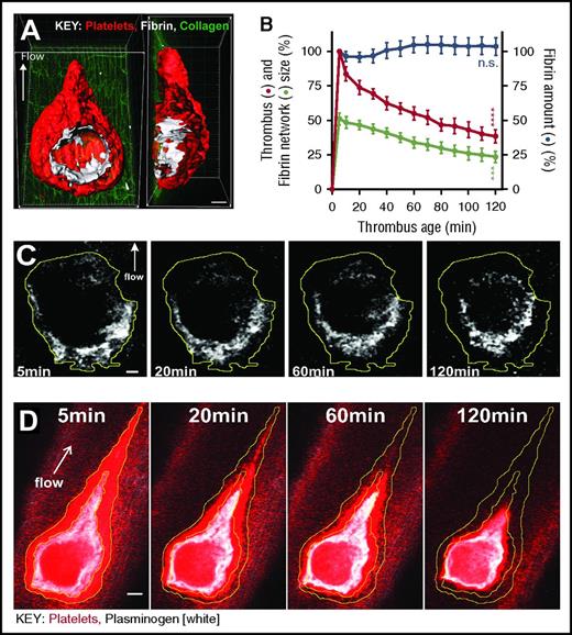 Figure 1. In vivo fibrin clot retraction occurs in the needle-injury model. (A) Images depict a 3-dimensional (3D) surface rendering of a representative thrombus, forming as a result of the needle-injury model in vivo. The surface of the platelet thrombus is in red (Dylight 649 anti-mouse GP1ba antibody), the surface of the fibrin network is in white (Alexa Fluor 546 anti-fibrin antibody), and the surface of collagen in the basement membrane is in green (autofluorescence). Supplemental Video 1 provides an animated perspective of this same thrombus and orthogonally cuts through the thrombus to highlight the underlying ring-shaped fibrin network, which is the key feature of the needle-injury model. (B) The thrombus size (red; left y-axis) and the area occupied by the fibrin network (green; left y-axis) were quantified (as described in “Methods”) and expressed as a percentage of thrombus size at 5 minutes. The total fibrin amount (blue; right y-axis) was also quantified (as described in “Methods”) and expressed as a percentage of the total fibrin amount at 5 minutes. The graph depicts the mean ± standard error of the mean (SEM). (n = 8); ***P < .001; ****P < .0001 by 2-way analysis of variance (ANOVA) relative to value at 5 minutes. (C) Confocal maximum-intensity projection of the ring-shaped fibrin network (detected via Alexa Fluor 546 anti-fibrin antibody), which reduces in size over the first 2 hours of thrombus lifetime. The superimposed yellow line outlines the fibrin network perimeter at 5 minutes. (D) A confocal maximum-intensity projection of a representative thrombus with platelets (Dylight 649 anti-mouse GP1bα antibody) and the plasminogenFITC-bound fibrin network both reducing in size over the first 2 hours of thrombus lifetime. The superimposed yellow lines show the periphery of the thrombus and its underlying fibrin network at 5 minutes. (A-B,D) The direction of blood flow (arrow) and scale bars (10 μm) are shown.