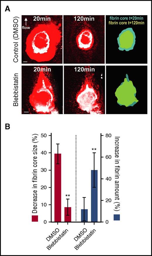 Figure 2. Inhibition of actomyosin-driven contractility inhibits fibrin clot retraction in vivo. Fibrin-dependent clot retraction was visualized over 120 minutes in vivo, as described in “Methods.” (A) Confocal maximum-intensity projection of platelets (Dylight 649 anti-mouse GP1ba antibody; red) and fibrin (Alexa Fluor 546 anti-fibrin antibody; white) within the same thrombus after 20 minutes (left column) or 120 minutes (middle column) in the absence/presence of the myosin II inhibitor blebbistatin. The right column depicts the size of the fibrin network after 20 and 120 minutes. The direction of blood flow (arrow) and scale bars (20 μm) are shown. (B) Quantification of the decrease in fibrin network size (red bars; left y-axis) and increase in fibrin amount (blue bars; right y-axis) over 120 minutes of thrombus maturation was performed, and data expressed as a percentage change from the fibrin size/amount at 5 minutes. Results depict the mean ± SEM (DMSO, n = 9; blebbistatin, n = 7); **P < .01 by unpaired 2-tailed Student t test.