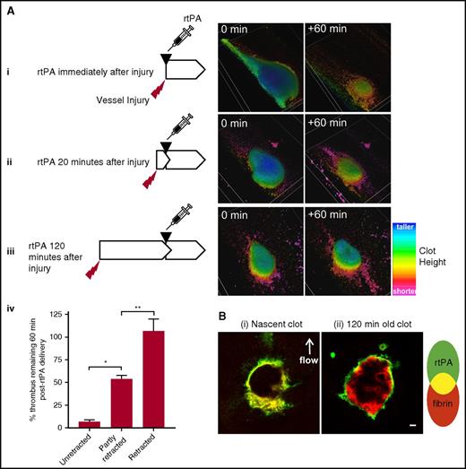 Figure 3. Clot retraction coincides with reduced rtPA-mediated lysis and penetration. (A) rtPA was administered during different stages of clot retraction onto: (i) nascent unretracted thrombi, (ii) partly retracted thrombi that were 20 minutes old, and (iii) retracted thrombi that were 2 hours old. Schematics summarize the experimental design (left column). 3D surface-rendered micrographs (right columns) show representative thrombi just before rtPA delivery (0 min) and 60 minutes (+60 min) after rtPA delivery. (iv) Collated quantification of thrombus size 60 minutes after rtPA delivery. Results depict mean + SEM where data are expressed as a percentage of thrombus size just before rtPA delivery. (i) n = 4, (ii) n = 8, and (iii) n = 8 mice. *P < .05 and **P < .01 by 1-way ANOVA with Tukey correction. (B) Inactive rtPA488 was administered onto (i) nascent thrombi or (ii) 2-hour-old retracted thrombi and the binding/penetration of inactive rtPA488 to fibrin (detected via Alexa Fluor 546 anti-fibrin antibody) was imaged via confocal micrograph 20 minutes later. Micrographs depict confocal sections through representative thrombi. The direction of blood flow (arrow) and scale bars (10 μm) are shown.