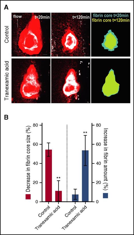 Figure 5. Inhibition of fibrinolysis with TXA attenuates fibrin clot retraction in vivo. Fibrin-dependent clot retraction was visualized over 120 minutes in vivo, in the absence or presence of TXA, as described in “Methods.” (A) Confocal maximum-intensity projection of platelets (Dylight 649 anti-mouse GP1bα antibody; red) and fibrin (Alexa Fluor 546 anti-fibrin antibody; white) within the same thrombus after 20 minutes (left column) or 120 minutes (middle column) in the absence/presence of TXA. The right column depicts the size of the fibrin network after 20 and 120 minutes. The direction of blood flow (arrow) and a scale bar (20 μm) are shown. (B) Collated quantification of the decrease in fibrin network size (red bars; left y-axis) and increase in fibrin amount (blue bars; right y-axis) over 120 minutes of thrombus maturation, with data expressed as a percentage change from the fibrin size/amount at 5 minutes. Results depict the mean ± SEM (saline control, n = 7; TXA, n = 4), where **P < .01 by the unpaired 2-tailed Student t test.