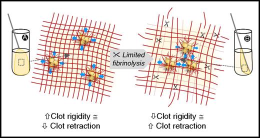 Figure 7. A proposed model of enhanced clot retraction in the presence of limited fibrinolysis. The studies presented here are consistent with the hypothesis that low concentrations of tPA-mediated plasmin formation trigger limited fibrinolysis, which in turn makes the fibrin network more amenable to compaction by platelet contractile forces. During blood clot development, platelets interact with fibrin polymers (red), with contractile force generated internally within the platelet transmitted to the external fibrin clot, resulting in retraction and fibrin clot shrinkage (A→B). The level of platelet-mediated clot shrinkage is balanced by the rigidity of the 3D fibrin network, which opposes platelet-mediated contractile forces (blue arrows). In the presence of limited tPA-mediated fibrinolysis, clot rigidity is reduced in a localized fashion (right), releasing forces opposing platelet contractility, resulting in increased fibrin clot retraction, via localized release of tension (B).