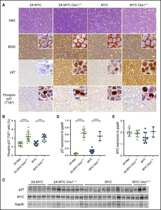Figure 6. P27kip1 levels remain high as observed in pretumor cells of tumors from Cks1 knockout LMP2A/λ-MYC and λ-MYC mice. (A) Representative immunohistochemical analysis of lymph node tumors from 3 to 6 mice of each genotype stained with hematoxylin and eosin, B220, p27kip1, and Thr187-phosphorylated p27kip1, using an EVOS XL core microscope with ×40 magnification. Insets are tumors imaged by a Nikon Eclipse E600 microscope with ×100 magnification and oil immersion. (B) Percentage of lymphoma cells with intense nuclear staining of Thr187-phosphorylated p27kip1 in total lymphoma cells per microscopic field (×40 magnification) analyzed by ImageJ software (National Institutes of Health). (C) Immunoblots of p27kip1 and MYC expression in tumor cells. (D) P27kip1 and (E) MYC expression were normalized to Gapdh (a loading control). Data represent the mean ± standard deviation. ***P < .001, ****P < .0001, calculated by 1-way ANOVA with post hoc multiple comparison tests.