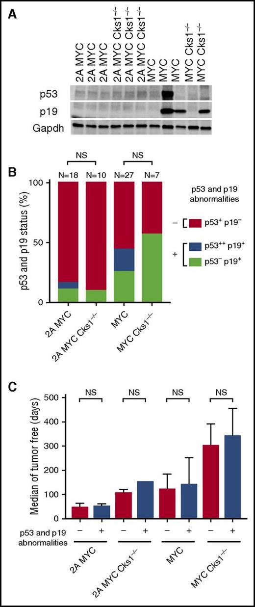 Figure 7. Cks1 knockout does not change the occurrence of p53 and/or p19ARF abnormalities in LMP2A/λ-MYC and λ-MYC tumors. The status of p53 and p19ARF expression in lymph node tumors from the indicated mouse genotype. (A) Representative immunoblots of p53 and p19ARF. (B) Combined data from several independent experiments. Statistical analyses were performed with Fisher’s exact test by comparing the frequency of p53 and p19ARF abnormalities in Cks1+/+ vs Cks1−/− within the LMP2A/λ-MYC or λ-MYC background. p53+ and p19−, baseline p53 and p19ARF levels as indicated by immunoblots; p53−, undetected baseline level of p53; p53++, aberrant p53 accumulation at ∼53 kDa; p19+, abnormal accumulation of p19ARF. (C) The number of tumor-free days in each indicated genotype. Medians with 95% confident intervals of ratios are indicated. Survival analyses were performed with both the log-rank (Mantel-Cox) test and Gehan-Breslow-Wilcoxon test by comparing the tumor-free days of the subgroups with (+) vs without (–) p53 and p19ARF abnormalities for each genotype. NS, not significant.