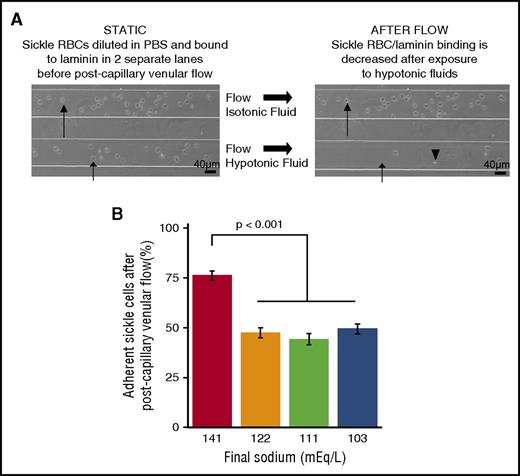 Figure 5. Admixture tonicity affects adhesion of sickle red cells to human laminin under post-capillary venular shear stress. (A) Brightfield microscopy images showing that sRBCs adhered to laminin become less adherent when exposed to hypotonic fluids at postcapillary shear stress. (Long arrow) sRBC exposed to isotonic fluid remaining adhered after flow. (Short arrow) sRBC exposed to hypotonic fluid becoming nonadherent and moving (arrowhead)). (B) sRBCs adhered to laminin-coated slides became less adherent after exposure to hypotonic fluids at postcapillary venule shear stress compared with admixtures containing higher sodium levels. (Bars and lines represent mean percentages ± standard error of the mean from N = 3 patients.)