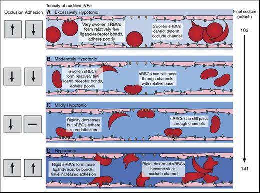 Figure 6. Effect of extracellular fluid tonicity on sickle red blood cell deformability and adhesion. (A) Exposure to excessively hypotonic admixtures increases occlusion risk for sRBCs resulting from excessive cellular hydration and swelling, although decreased microvascular adhesion is observed. (B) sRBCs exposed to moderately hypotonic admixtures exhibit increased deformability and decreased adhesion in our microfluidic models. (C) Exposure to mildly hypotonic admixtures increases sRBC adhesion to endothelium but decreases adhesion to laminin. Optimal deformability through microchannels, with decreased occlusion, is maintained. (D) Admixtures with increased sodium levels increase adhesion and occlusion risk in our microvascular models. Increased occlusion from exposure to these higher sodium levels was observed under both normoxic and hypoxic conditions.