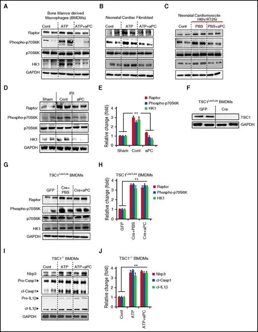 Figure 4. aPC restricts inflammasome by suppressing mTORC1. (A-C) Expression of Raptor, and HK1 and phosphorylation (phospho) of ribosomal p70-S6 kinase (pS6K70) were analyzed in LPS-primed and ATP-challenged BMDMs (A) and mouse neonatal cardiac fibroblasts (B) or mouse neonatal cardiomyocytes subjected to hypoxia/reoxygenation (H/R) (C). aPC inhibits expression of Raptor and HK1 and p70S6K phosphorylation levels in LPS-primed and ATP-stimulated cells (A-B) or in H/R-injured primary cardiomyocytes (C). (D-E) Treatment of mice with aPC inhibits mTORC1 signaling; representative immunoblots showing cardiac Raptor and HK1 expression as well as total and phosphorylated pS6K70. Representative immunoblots (D) and bar graph summarizing results (E). (F-J) BMDMs from TSC1LoxP/LoxP mice were transiently transfected with GFP- or Cre-expressing plasmids, resulting in loss of TSC1 expression after 48 hours. Representative immunoblots of TSC1, with glyceraldehyde-3-phosphate dehydrogenase (GAPDH) as loading control (cont) (F). (G-H) In TSC1-deficient BMDM cells, aPC treatment fails to reduce Raptor or HK1 expression or phosphorylation of p70S6K (TSC1LoxP/LoxP+Cre+aPC) when compared with PBS-treated cells (TSC1LoxP/LoxP+Cre+PBS) Representative immunoblots (G) and bar graph summarizing results (H). (I-J) Likewise, aPC fails to reduce Nlrp3 expression or cl-Casp1 or cl–IL-1β in TSC1-deficient BMDMs. Representative immunoblots (I) and bar graph summarizing results (J). (I) Arrowheads indicate inactive (white) and active (black) forms of caspase-1 or IL-1β. (J) The active form was quantified. Data shown represent mean ± SEM. Data obtained from at least 3 independent experiments each with at least 2 technical replicates (A-J); GAPDH as loading control (A-D,F-G,I). **P < .01; analysis of variance (E,H,J).