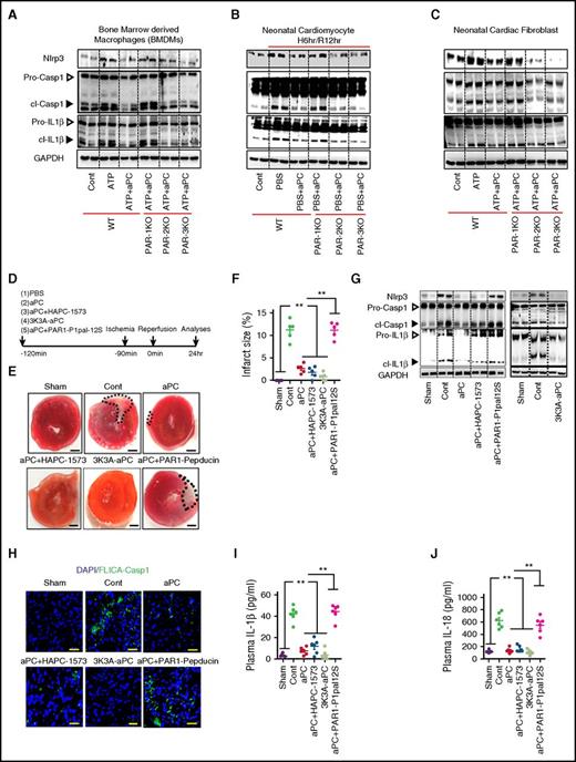 Figure 5. aPC restricts inflammasome activation via PAR-1 after myocardial IRI. (A-C) The effect of aPC on inflammasome activation was analyzed after receptor inhibition. BMDMs (A), neonatal cardiomyocytes (B), or neonatal cardiac fibroblasts (C) were isolated from wild-type (WT), PAR-1−/−, PAR-2−/−, or PAR-3−/− mice. aPC fails to supress LPS/ATP- (A,C) or hypoxia/reoxygenation-induced (B) Nlrp3 expression and cl-Casp1 and cl–IL-1β in the absence of PAR-1 in all cell types, whereas loss of other receptors had no effect; representative immunoblots, with glyceraldehyde-3-phosphate dehydrogenase (GAPDH) as loading control (A-C). (D) Experimental design. (E-F) Treatment of mice with aPC-HAPC1573 complex or 3K3A-aPC reduces the infarct size as efficiently as aPC, and blocking PAR-1 signaling (pepducin P1pal-12S) abolishes the inhibitory effect of aPC. Representative heart sections showing infarcted area detected by triphenyl tetrazolium chloride staining (area encircled by dashed line; size bar, 20 µm) (E) and dot plots summarizing data (F). (G-J) Treatment of mice with aPC-HAPC1573 complex or 3K3A-aPC reduces markers of inflammasome activation as efficiently as aPC, and blocking PAR-1 signaling (pepducin P1pal-12S) abolishes the inhibitory effect of aPC. (G) Representative immunoblots of cardiac Nlrp3 expression and cl-Casp1 and cl–IL-1β, with GAPDH as loading control (cont); arrowheads indicate inactive (white) and active (black) forms of caspase-1 or IL-1β. (H) Representative images of active caspase-1 within the infarcted tissue (frozen sections incubated with FLICA-Casp1 probes; size bar, 20 µm). Dot plots summarizing plasma IL-1β (I) and IL-18 (J) levels. Sham-operated (sham) or mice with myocardial IRI without (PBS; cont), with aPC (aPC), with aPC-HAPC1573 complex (aPC+HAPC1573), with an aPC variant specifically lacking anticoagulant function (3K3A-aPC), or with aPC and PAR-1 pepducin P1pal-12S (aPC+P1pal-12S) pretreatment. Data shown represent mean ± SEM. Data obtained from at least 3 independent experiments each with at least 2 technical replicates (A-C) or from at least 6 mice per group (D-J). **P < .01; analysis of variance (F,I-J).