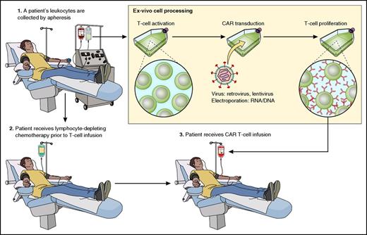 Figure 2. A representation of the CAR-T therapy process is shown. Cells are harvested from patients by apheresis. T cells are activated and genetically modified with a CAR gene that will lead to expression of a CAR protein on the T cells. Genetic modification is carried out with a gene-therapy vector such as a γ-retrovirus or a lentivirus. CAR-expressing T cells proliferate ex vivo. Patients often receive a chemotherapy conditioning regimen to deplete endogenous leukocytes with a goal of enhancing CAR-T activity. After completion of the conditioning chemotherapy regimen, CAR-Ts are infused. Professional illustration by Patrick Lane, ScEYEnce Studios.