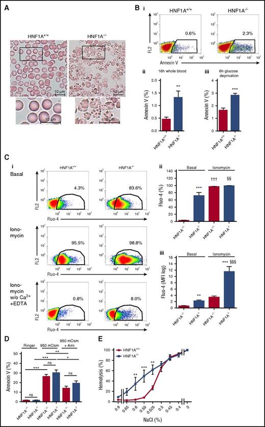 Figure 3. Wright-Giemsa staining, PS exposure, intracellular calcium, sensitivity to hyperosmolarity, and osmotic fragility of HNF1A−/−RBCs. (A) Representative light microscopy images of Wright-Giemsa–stained peripheral blood smears (n = 3; original magnification ×100) of HNF1A+/+ and HNF1A−/− mice. Bars represent 10 μm. (B) Representative images of annexin V flow cytometric analysis of HNF1A+/+ (n = 6) and HNF1A−/− (n = 6) RBCs, 16 hours after collecting peripheral blood samples and incubation at room temperature. The FL2 channel was empty (i). Quantification of the mean percentage of annexin V binding on HNF1A+/+ and HNF1A−/− RBCs (n = 6 each) 16 hours after collecting blood samples (ii) or 6 hours after glucose deprivation of washed RBCs (iii). **P < .01 and ***P < .001 (Student t test). (C) Representative flow cytometric analysis of intracellular calcium content in HNF1A+/+ and HNF1A−/− RBCs prestained with Fluo-4 and incubated in Ringer without (i, top) and with ionomycin (1 µM; i, middle), with ionomycin (1 µM; i, bottom) in Ringer without Ca2+ in the presence of 1 mM EDTA measured after 2 minutes of incubation. The FL2 channel was empty. Quantification of the percentage (ii) and mean fluorescence intensity (MFI) (iii) of HNF1A+/+ (n = 4) and HNF1A−/− (n = 4) RBCs positive for Fluo-4. **P < .01 and ***P < .001 for untreated HNF1A+/+ vs HNF1A−/−, †††P < .001 for treated vs untreated HNF1A+/+ and §§P < .01 and §§§P < .001 for treated vs untreated HNF1A−/− (1-way ANOVA followed by Tukey post hoc analysis). (D) Mean percentage of annexin V binding on HNF1A+/+ and HNF1A−/− RBCs (n = 3 each) 4 hours after incubation with 950 mOsm Ringer solution in the presence or absence of 50 µM amitriptyline (Ami). *P < .05, **P < .01, and ***P < .001 for 950 mOsm vs untreated HNF1A+/+ or vs 950 mOsm plus Ami; for 950 mOsm vs untreated HNF1A−/− or vs 950 mOsm plus Ami as indicated (1-way ANOVA followed by Tukey post hoc analysis). (E) Osmotic fragility in RBCs from HNF1A+/+ and HNF1A−/− mice (n = 3 each) using solutions with decreasing concentrations of NaCl. **P < .01 and ***P < .001 for untreated vs treated RBCs (2-way ANOVA followed by Bonferroni post hoc analysis). ns, not significant.