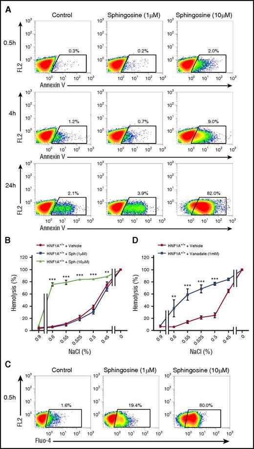 Figure 4. Effects of sphingosine on PS exposure, osmotic fragility, and intracellular calcium in WT RBCs. (A) Flow cytometry for annexin V on WT RBCs treated with different sphingosine concentrations (1 µM or 10 µM) or vehicle (ethanol, control) or for several time points as indicated. The FL2 channel was empty. (B) Osmotic fragility in WT RBCs (n = 3) pretreated with different sphingosine (Sph) concentrations or vehicle (ethanol) for 6 hours. (C) FACS plots of WT RBCs preloaded with Fluo-4 and exposed to Ringer with sphingosine (1 µM or 10 µM) or vehicle (ethanol, control) for 30 minutes. The FL2 channel was empty. (D) Osmotic fragility in WT RBCs (n = 3) pretreated with vanadate (1 mM) or vehicle (H2O) for 1 hour at 37°C using solutions with decreasing concentrations of NaCl. **P < .01 and ***P < .001 for untreated vs treated RBCs (2-way ANOVA followed by Bonferroni post hoc analysis for panels B,D).