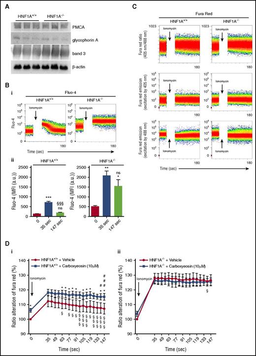 Figure 5. Effects of carboxyeosin on intracellular calcium levels in HNF1A+/+ and HNF1A−/−RBCs. (A) Immunoblot analysis showing PMCA, band 3, glycophorin A, and β-actin protein expression in RBC ghosts prepared from HNF1A+/+ and HNF1A−/− mice (n = 3 each). (B) Representative FACS plots of intracellular calcium kinetics measured in Fluo-4–loaded HNF1A+/+ and HNF1A−/− RBCs under basal conditions and after subsequent ionomycin treatment (i). Flow cytometric determination of intracellular Ca2+ changes over time as measured by the emission of Fluo-4–loaded HNF1A+/+ (n = 4) and HNF1A−/− RBCs (n = 4) under basal conditions (set as t = 0) and after subsequent ionomycin treatment (t = 35 seconds and t = 147 seconds) (ii). ***P < .001 for untreated HNF1A+/+ vs treated HNF1A+/+. §§§P < .001 for t = 35 seconds vs t = 147 seconds HNF1A+/+. *P < .05 and **P < .01 for untreated vs treated HNF1A−/−. (C) FACS plots of intracellular calcium kinetics measured in Fura Red–loaded HNF1A+/+ and HNF1A−/− RBCs as emission ratio (405 nm/488 nm) and fluorescence emission intensities at each of the 2 component wavelengths (FL10 excited by 405 nm and FL4 excited by 488 nm) under basal conditions and after ionomycin. (D) Flow cytometric determination of intracellular Ca2+ changes over time as measured by the ratio alteration of Fura Red–loaded HNF1A+/+ (n = 3) (i) and HNF1A−/− (n = 3) (ii) RBCs after incubation for 30 minutes (set as 100%) with the PMCA inhibitor carboxyeosin (CE) (10 μM) or vehicle (DMSO) under basal conditions (set as t = 0) and after subsequent ionomycin treatment. *P < .05 for untreated HNF1A+/+ vs treated HNF1A+/+ RBCs. §P < .05 and §§§P < .001 for ionomycin-treated RBCs (t = 35 seconds vs every later time point). #P < .05 and ###P < .001 for ionomycin- and CE-treated RBCs (t = 35 seconds vs every later time point).
