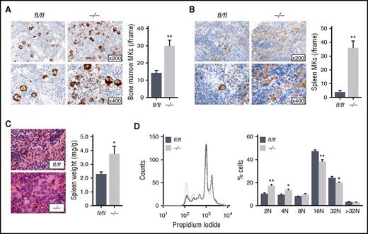 Figure 2. Ck2β−/− mice display BM MK hyperplasia and an upregulation of extramedullary thrombopoiesis. (A) Representative images of GPIb immunostaining of BM sections from 2-month-old ck2βfl/fl and ck2β−/− mice (left). Quantification of ck2βfl/fl and ck2β−/− BM MKs per visual field. Arithmetic means ± standard errors of the means (n = 6; right) are shown. (B) Representative images of GPIb immunostaining of spleen sections from 6-month-old ck2βfl/fl and ck2β−/− mice (left). Quantification of ck2βfl/fl and ck2β−/− spleen MKs per visual field. Arithmetic means ± standard errors of the means (n = 6; right) are shown. (C) Representative H&E staining of spleen sections from 6-month-old ck2βfl/fl and ck2β−/− mice (left). Arithmetic means ± standard errors of the means (n = 8; right) of relative spleen weight in ck2βfl/fl and ck2β−/− mice. (D) Ploidy histogram of ck2βfl/fl and ck2β−/− MKs (left) and arithmetic means ± standard errors of the means (n = 6; right) are shown. Unpaired Student t test. *P < .05; **P < .01.