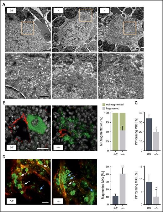 Figure 3. Ck2β−/− MKs exhibit abnormal ultrastructure, resulting in premature MK fragmentation in the BM and impaired proplatelet formation. (A) Representative TEM images of ck2βfl/fl (left) and ck2β−/− (middle and right) MKs in the BM showing increased fragmentation, decreased presence of demarcation membranes, and large granule-free zones on ck2β deficiency. Upper, overview (bar represents 3 μm). Lower, detail (bar represents 1 μm). (B) Representative confocal microscopy images of immunostained BM sections (left) and arithmetic means ± standard errors of the means (n = 6; right) of MK fragmentation in the BM of ck2βfl/fl and ck2β−/− mice (n = 6). Green, MKs (GPIb); red, sinusoids (CD105); gray, nuclei (4′,6-diamidino-2-phenylindole). Bar represents 20 μm. (C) Quantification of the percentage of proplatelet-forming fetal liver cell–derived MKs from ck2βfl/fl and ck2β−/− mice in vitro on day 4 of culture. Ck2βfl/fl and ck2β−/− MKs extending proplatelets were counted 18 hours after bovine serum albumin gradient and expressed as percentage of total MKs. Arithmetic means ± standard errors of the means (n = 10) are shown. (D) 2P-IVM revealing MK instability and reduced proplatelet formation in ck2β−/− MKs in vivo. Platelets and MKs were stained with anti-GPIX antibodies (green), and the vessel lumen was labeled using fluorescein isothiocyanate-bovine serum albumin and anti-CD105 antibodies (red). Proplatelet-forming MKs (white arrows indicated proplatelets) were counted, and the ratio per mouse was assessed (n = 5). MK morphology was categorized by a blinded experimenter in normal and fragmented (blue arrows). Representative images from the BM of ck2βfl/fl and ck2β−/− MKs (left) and arithmetic means ± standard errors of the means (n = 5; right) of proplatelet-forming MKs and of MKs with altered morphology are shown. Bar represents 50 µm. Unpaired Student t test in panels C and D. *P < .05; **P < .01.
