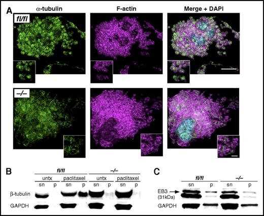 Figure 4. CK2β is essential for microtubule architecture and tubulin polymerization as well as EB3 binding to polymerized tubulin. (A) Representative immunofluorescence confocal microscopy images of cultured fetal liver–derived ck2βfl/fl and ck2β−/− MKs. α-Tubulin staining appears fragmented in Ck2β−/− MKs undergoing proplatelet formation. Bar represents 20 μm (overview) and 5 μm (detail). (B) Representative immunoblots of 3 independent experiments of free and polymerized tubulin in ck2βfl/fl and ck2β−/− platelets (n = 3) in the absence and presence of paclitaxel (10 μM) in supernatant (sn) and pellet (p). (C) Representative immunoblots of EB3 bound to polymerized tubulin in ck2βfl/fl and ck2β−/− platelets (n = 3) after treatment with paclitaxel (10 μM) in supernatant (sn) and pellet (p).