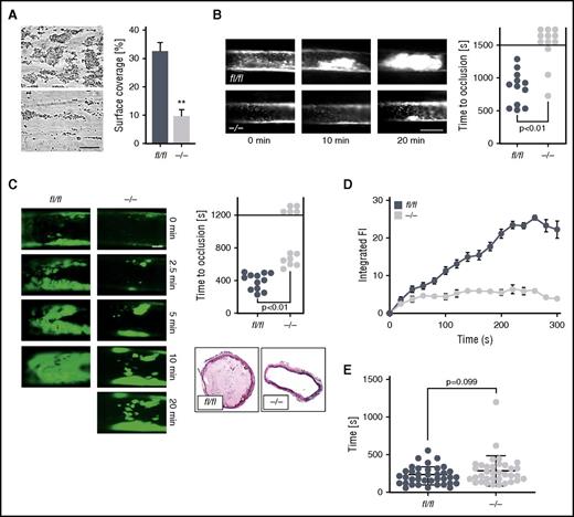 Figure 6. Ck2β deficiency results in significantly reduced platelet adhesion and thrombus stability under high arterial shear rates as well as abrogated thrombotic vascular occlusion in vivo, whereas primary hemostasis is not significantly affected. (A) Flow chamber analysis of platelet adhesion to collagen and thrombus formation in vitro under high arterial shear rates. Whole blood from ck2βfl/fl and ck2β−/− mice was perfused over a collagen-coated surface for 5 minutes at a shear rate of 1700 s−1. Arithmetic means ± standard errors of the means (n = 6; right) and representative phase contrast images (left) of surface coverage are shown. Bar represents 50 µm. (B) Time to arterial occlusion after FeCl3-induced injury of mesenteric arterioles (right, n = 12) and representative images of occlusive in vivo thrombus formation after 0, 10, and 20 minutes (left) in ck2βfl/fl and ck2β−/− mice. Each dot represents 1 individual mouse. Bar represents 50 µm. (C) Representative images of in vivo thrombus formation after 0, 2.5, 5, 10, and 20 minutes (left) and time to arterial occlusion after FeCl3-induced injury of carotid arteries (upper right, n = 12) and representative immunohistological H&E staining (lower right) of occlusive in vivo thrombus formation after 7 minutes in ck2βfl/fl and ck2β−/− mice. Each dot represents 1 individual mouse. Bar represents 100 µm. (D) Arithmetic means ± standard errors of the means (n = 6) of integrated fluorescence intensity of adherent platelets after perfusion of whole blood from ck2βfl/fl (blue dots) and ck2β−/− (gray dots) mice over a collagen-coated surface representing thrombus growth in vitro over 5 minutes. (E) Tail bleeding time measured after amputating the tail tip of ck2βfl/fl and ck2β−/− mice. Each dot represents 1 individual mouse (n = 36). Unpaired Student t test in panels A-E. **P < .01.