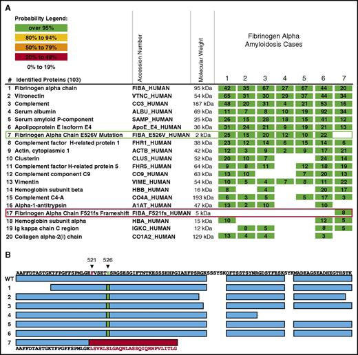 Figure 2. The C-terminal mutant region predicted by Phe521Leufs is detected in renal amyloid deposits, but not its wild-type counterpart. (A) The results of LMD/MS-based proteomics analysis of amyloid plaques from 7 cases of AFib. Cases 1 to 6 carry the Aα-chain Glu526Val (E526V) variant, and case 7 the Phe521Leufs (F521fs) variant. The identified proteins are listed by relative probability score for identity, and the top 20 proteins of 103 proteins are shown. The columns show the protein name, the UnitProt identifier (protein accession number in the UniProt database, http://www.uniprot.org/), the molecular weight of the protein, and 1 microdissection from 7 patient specimens involved by AFib. The numbers indicate the number of total peptide spectra identified for each protein. Fibrinogen Aα-chain is the most abundant protein amyloidogenic in this sample set, consistent with AFib amyloidosis in each case. To show the presence of mutated proteins in the amyloid plaques, the raw mass spectrometry data files were searched using the human SwissProt database supplemented with Aα-chain variants Glu526Val and Phe521Leufs. Consistent with genetic analysis, cases 1 to 6 contain the tryptic peptide carrying the Glu526Val variant (row 7, green rectangle), whereas this variant is not present in the case with the Phe521Leufs variant. In contrast, the novel tryptic peptides generated by the frameshift in Phe521Leufs variant are only present in case 7 (row 17, red rectangle). (B) shows the Aα-chain protein coverage in 7 cases of AFib amyloidosis. Cases 1 to 6 carry the Glu526Val variant, and case 7 the Phe521Leufs variant. The top line represents the C-terminal sequence of native Aα-chain. The amino acid residues of Phe521Leufs (F521 in red) and Glu526Val (E526 in green) are indicated. The first line of rectangles (blue) labeled “WT” represents the coverage of the wild-type Aα-chain by the mass spectrometry-based proteomic method used. Two samples (S1 and S2) from 4 patients are shown. In cases 1 to 6 (Glu526Val variant), most of the coverage is identical to the wild-type Aα-chain except for the tryptic peptide carrying the point mutation (green rectangle) instead of the amino acid present in the wild-type peptide. In case 7 (Phe521Leufs), frameshift leads to a novel sequence indicated by the red rectangle and amino acid sequence in red letters. No native Aα-chain peptides are present after the frameshift mutation, indicating that only the mutant Aα-chain is present in amyloid deposits.