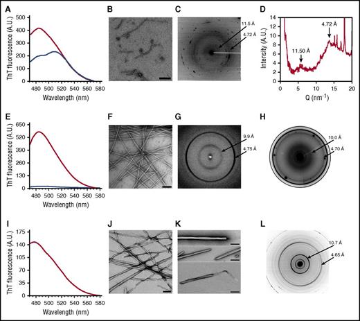Figure 4. In vitro fibrillogenesis and structural analysis of Aα-chain frameshift-derived polypeptides identified in amyloid deposits in vivo. (A) ThT fluorescence assays performed on AFFDTASTGKTFPGFFSPMLGELSVRLSLGAQNLASSQIQRNPVLITLG (red curve) and AFFDTASTGKTFPGFFSPMLGELSVRLSLGAQNLASSQIQRNP_G (blue curve). Characteristic enhanced ThT fluorescence at 485 nm was only observed for AFFDTASTGKTFPGFFSPMLGELSVRLSLGAQNLASSQIQRNPVLITLG, suggesting that this peptide formed amyloid β-sheet structures. In contrast, a spectral red shift at 510 nm was recorded for AFFDTASTGKTFPGFFSPMLGELSVRLSLGAQNLASSQIQRNP_G, suggesting that it does not form typical amyloid β-sheet structures. (B) Transmission electron micrographs showed that AFFDTASTGKTFPGFFSPMLGELSVRLSLGAQNLASSQIQRNPVLITLG forms fibrillar aggregates, and AFFDTASTGKTFPGFFSPMLGELSVRLSLGAQNLASSQIQRNP_G spherical aggregates. (C) Fibrils formed by AFFDTASTGKTFPGFFSPMLGELSVRLSLGAQNLASSQIQRNPVLITLG exhibited a meridional peak at 4.72 Å, indicating the spacing between β-strands within fibrils associated with an equatorial reflection at 11.50 Å. This microdiffraction pattern confirms the presence of the characteristic amyloid cross-β architecture constituted by intermolecular β-sheets with β-strands oriented perpendicular to the fibril axis. (D) An extracted radial profile from the two-dimensional pattern shown in panel C. The noisy background is because of the small angle used for the profile extraction to avoid the intense peaks from salts in the sample. (E) Data from ThT fluorescence assays performed on ASSQIQRNPVLITLG (red curve) and ASSQIQRNP_G (blue curve), revealing that only ASSQIQRNPVLITLG induces enhanced fluorescence at 485 nm and that only the peptide containing VLITL forms aggregates with β-sheet conformation. (F) Transmission electron micrographs showed that ASSQIQRNPVLITLG forms aggregates of fibrillar morphology. (G) XRD profiles of ASSQIQRNPVLITLG fibrils displaying the typical “cross-β” microdiffraction pattern of amyloid fibrils with a spacing of 4.75 Å along the meridional direction and a periodicity of 9.90 Å in the equatorial direction. (H) The in situ XRD pattern from a cut of the pathological kidney specimen of patient II.2 with in vivo amyloid fibrils, showing meridional (4.71 Å) and equatorial (10.0 Å) reflections. (I) A ThT fluorescence assay of VLITL with increased fluorescence intensity at 485 nm, demonstrating that the dye bound to β-sheet-enriched amyloid fibrils. (J and K) Transmission electron micrographs of mature VLITL fibrils with ribbonlike structures at different magnifications. Frayed ribbons are observed at the ends of the VLITL twisted fiber structures. The scale bar represents 200 nm. (L) The VLITL fibrils exhibited strong meridional (4.65 Å) and equatorial (10.7 Å) reflections characteristic of a cross-β pattern, confirming their amyloid nature.