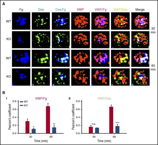 Figure 5. Loss of VAMP-3 affected transit of cargoes to α-granules. (A) Washed platelets (1 × 109/mL) were incubated with Alexa 647-Fg and Oregon green 488-Dextran at final concentrations of 1 µM each and incubated at 37°C for 30 to 60 minutes and prepared for immunofluorescence microscopy, as described in Methods. Platelets were incubated with anti-VWF rabbit polyclonal antibody (1:500 dilution) and then with Alexa 568-conjugated goat anti-rabbit immunoglobulin G secondary antibody (1:1,000 dilution). Images were taken using the Nikon Ti-E N-STORM/N-SIM super-resolution microscope, and digitally magnified by ×30. The Alexa 647-Fg signal was faux colored blue to aid in identifying overlaps. Scale bar, 1 µm. Data are representative of 2 independent experiments. (B) Pearson’s correlation coefficients were calculated using the NIS-Elements v3.2 N-SIM/STORM suite software to show overlap between (i) Alexa 568-VWF and Alexa 647-Fg (depicted in magenta) and (ii) Alexa 568-VWF and Oregon Green 488-Dextran (depicted in yellow) at the indicated times. Overlap of all 3 fluorophores is depicted in white in the merge panel. Graph shows the mean ± SEM of 2 independent experiments, with at least 30 cells per field, taken over 3 to 4 fields per time. Statistical analyses were performed using Student t test; *P ≤ .05; **P ≤ .01; ***P ≤ .001; n.s., not significant.