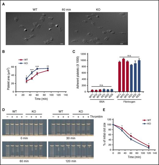Figure 6. VAMP-3−/− platelets spread faster on Fg and had enhanced clot retraction. (A) Representative images of WT and VAMP-3−/− platelets allowed to spread on fibrinogen (50 µg/mL in 1× PBS) for 60 minutes are shown. Images of spread platelets were taken using DIC microscopy as described in supplemental Methods. Exposure times for DIC images were 100 ms. Scale bars, 5 μm. (B) Quantification of platelet surface area from WT and VAMP-3−/− Fg-spread platelets for indicated times. Data are representative of 2 independent experiments (mean ± SEM). (C) Quantification of static adhesion on 50 μg/mL human Fg and 5% bovine serum albumin-coated surfaces for WT and VAMP-3−/− calcein-labeled platelets harvested from 3 different VAMP-3−/− and WT mice. Adherent platelets were measured by fluorescence, using a SpectraMax plate reader. Data were plotted using SigmaPlot software (v13.0). (D) Representative images of thrombin-stimulated (0.05 U/mL; denoted by +) clot retraction in WT and VAMP-3−/− platelets at increasing times. (E) Clot sizes were measured, and the percentages of clot size relative to initial suspension volume (measured at time 0 and set as 100%) were determined and plotted. Three different VAMP-3−/− and corresponding WT littermate controls were used in this experiment. Statistical analyses were performed using the Student t test; *P ≤ .05; **P ≤ .01; ***P ≤ .001; n.s., not significant.