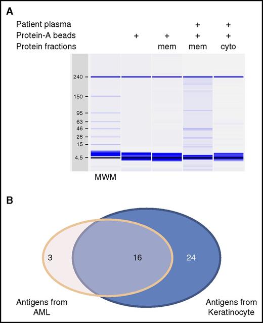 Figure 4. Identification of targeted antigens by cell-based immunoprecipitation. (A) Analysis of the immunoprecipitation product with cGVHD patient plasma and keratinocyte cells by capillary protein gel electrophoresis. (B) Summary of the unique antigens identified when cell lines indicated were used. cyto, cytoplasmic fraction; mem, membrane fraction; MWM, molecular weight marker.