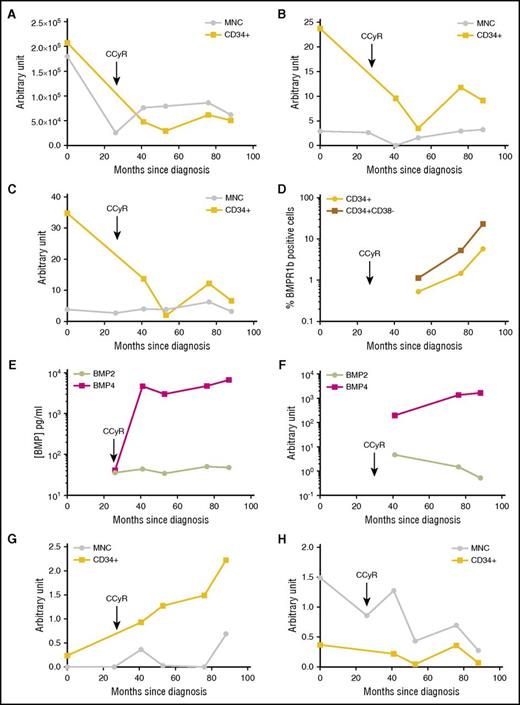 Figure 5. Long-term follow-up of a demonstrative patient who became refractory to all TKI treatments. Follow-up for 88 months of a newly diagnosed CP-CML patient. Since diagnosis, this patient had no detectable BCR-ABL mutation, had an intermediate Sokal, and received dasatinib as first-line therapy. BM and PB samples were harvested after 26 months of treatment (still in CCyR) then upon resistance after 41, 53, 76, and 88 months after diagnosis. Follow-up of transcriptional expression was performed for BCR-ABL (A), TWIST-1 (B), and BMPR1b (C) genes in MNC- or CD34+-selected cells, as indicated on the graphs. Results from each analyzed sample are expressed in arbitrary units. (D) Cell membrane expression of BMPR1b was analyzed by flow cytometry on CD34+ or CD34+CD38− selected cells. (E) ELISA quantification of BMP2 and BMP4 in BM plasma at the indicated time of harvest. Results from each sample are expressed in picograms per milliliter. (F) Follow-up of transcriptional expression was performed for BMP2 and BMP4 genes in mesenchymal stem cells isolated from BM harvested after 53, 76, and 88 months after diagnosis. Follow-up of transcriptional expression was performed for BMP4 (G) and BMP2 (H) genes in MNC- or CD34+-selected cells, as indicated on the graphs.