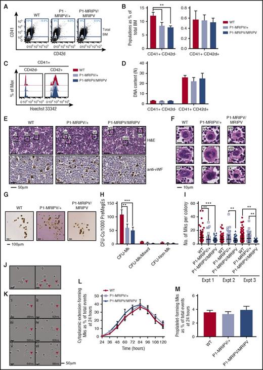 Figure 3. Deleting the Runx1 distal isoform does not affect megakaryocyte maturation. (A-D) FACS analysis of BM WT, P1-MRIPV/+, and P1-MRIPV/MRIPV megakaryocytes. (A) Representative FACS plots of CD41 and CD42d expression; (B) quantification of CD41+ CD42d−, and CD41+ CD42d+ megakaryocytes (N = 6). (C) Representative FACS plots of DNA content (Hoechst 33342 incorporation) of CD41+ CD42d− (left) and mature CD41+ CD42d+ (right) BM megakaryocytes. (D) Mean ploidy (DNA content) of CD41+ CD42d−, and CD42d+ BM megakaryocytes (N = 3). (E-F) Histological analysis of BM megakaryocytes. (E, top) Hematoxylin and eosin (H&E)-stained BM sections. (Bottom) Anti-mouse von Willebrand factor (vWF)-stained BM sections. (F) Enlarged images of megakaryocytes i-ix as indicated in panel E. Representative images from 3 independent experiments are shown. (G-I) CFU-C activity of WT, P1-MRIPV/+, and P1-MRIPV/MRIPV PreMegE cells following culture in MegaCult medium. (G) Photographs of representative MegaCult colonies; (H) colony (CFU-C) numbers per 1000 PreMegEs (N = 5); (I) numbers of megakaryocytes per CFU-Mk colony from 3 representative independent experiments (mean ± standard deviation, Mann-Whitney U test). (J-M) Megakaryocyte differentiation in vitro captured by time lapse imaging. (J) Representative images of cytoplasmic extension-forming megakaryocytes (red arrowheads); (K) representative images of a proplatelet-forming megakaryocyte (red arrowheads) at 48 to 68 hours in culture. (L) Quantitation of cytoplasmic extension-forming megakaryocytes from 24 to 120 hours in culture, normalized to the total number of events (visible cells) at 24 hours; (M) quantitation of proplatelet-forming megakaryocytes from 24 to 120 hours normalized to the total number of events at 24 hours (N = 6). *P < .05, **P < .01, ***P < .001, ****P < .0001. Expt, experiment.
