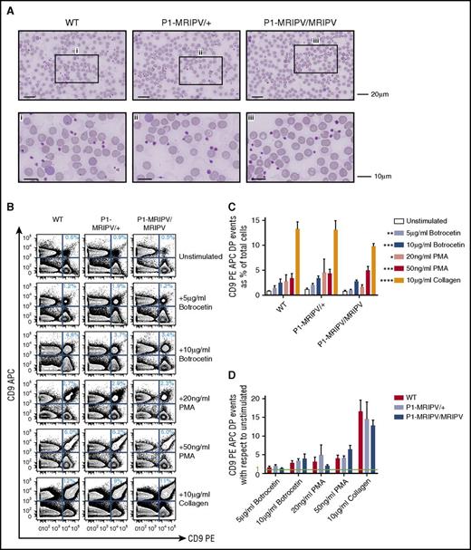Figure 4. Platelet function is not impaired by the absence of RUNX1C. (A) Morphologic analysis of peripheral blood cells, in particular platelets. May-Grünwald-Giemsa–stained peripheral blood films. The bottom panel consists of enlarged images of sections indicated in the top panel. Representative images from 4 independent experiments are shown. (B-D) Assessment of platelet aggregation in vitro. (B) Representative FACS plots of CD9 APC and CD9 PE staining of unstimulated PRP and PRP treated with various agonists as indicated. (C-D) Quantitation of platelet aggregation (percent CD9 APC PE double positive events) in unstimulated and stimulated PRP (C, P values shown as compared with unstimulated) and fold increase in CD9 APC PE double positive aggregates following treatment with various agonists with respect to unstimulated PRP (D) (N = 4). *P < .05, **P < .01, ***P < .001, ****P < .0001. APC, allophycocyanin; PMA, phorbol 12-myristate 13-acetate.