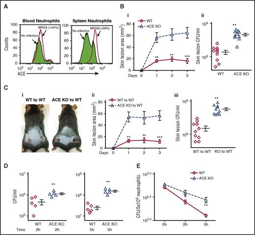Figure 1. ACE plays a physiological role in antibacterial defense. (A) Neutrophil ACE expression in response to MRSA stimulation. WT mice were injected IV with MRSA. After 48 hours, ACE expression was determined in CD11b+Ly6G+ neutrophils by FCM. The figure is representative of 5 mice. ACE expression was increased in both blood and splenic neutrophils following MRSA infection. (B) Resistance to MRSA infection in WT (◊) and ACE KO (Δ) mice. Groups of mice were infected subcutaneously with MRSA (1 × 107 CFU/mouse flank). (i) Skin lesion area per day postinfection, (ii) Bacterial burden in individual lesions on day 3 postinfection. (C) Bacterial resistance following transplantation of either WT or ACE KO BM. (i) Representative image of skin lesions at day 3 post-infection, (ii) Skin lesion area, (iii) Bacterial burden per lesion. (D) In vitro MRSA clearance by blood from WT mice or ACE KO mice. Following infection with ∼106 CFU/mL MRSA, blood samples from mice were assessed for their ability to eliminate MRSA after 2 or 5 hours of incubation. (E) In vitro intracellular killing of MRSA in neutrophils purified from bone marrow. Intracellular killing was significantly lower in ACE KO compared with WT neutrophils (n = 8/group). *P ≤ .05, **P ≤ .005, ***P ≤ .0005.