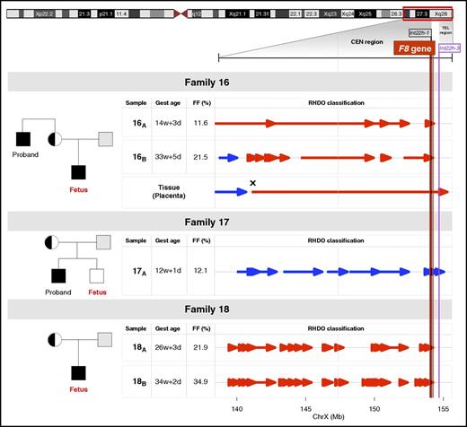 Figure 1. Noninvasive prenatal testing for hemophilia families with F8 int22h-related inversions. Pedigree for 3 families with a history of hemophilia examined by a targeted MPS and RHDO approach. Genotypes of the mother and proband in family 16 and family 17, or the mother and the placental tissue in family 18, were used in a haplotype analysis to infer fetal inheritance of F8 int22h-related inversions. The informative SNPs that were heterozygous in the mother (AB) and hemizygous in proband (A-) were selected. The SNP alleles found in proband belonged to the haplotype linked with the F8 int22h-related inversion (Hap I, red). The SNP alleles absent from the proband belonged to the haplotype not linked with the F8 int22h-related inversion (Hap II, blue). The tail and tip of an arrow denote the start and end, respectively, of a RHDO block. Vertical red, black, and purple lines correspond to the location of the F8 gene and int22h-1 and int22h-3 homologs on chromosome X, respectively. The vertical dashed gray line illustrates a centromere-region boundary. For family 16 and family 18, the fetus had inherited Hap I from the mother, where the haplotype blocks in the F8 region were found to be linked to the proband’s int22h-related inversion. The cross symbol in the placental tissue in family 16 indicates a recombination event in the chromosome position chrX: 141,078,676. In family 17, haplotype blocks in the F8 region were found to be linked to Hap II, suggesting the presence of an unaffected fetus. CEN region and TEL region, centromeric and telomeric region, respectively; FF, fetal DNA fraction; Gest age, gestational age.